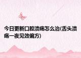 今日更新口腔溃疡怎么治(舌头溃疡一夜见效偏方)