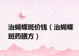 治蝴蝶斑价钱（治蝴蝶斑药膳方）