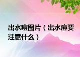出水痘图片（出水痘要注意什么）