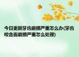 今日更新牙齿磨损严重怎么办(牙齿咬合面磨损严重怎么处理)
