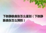 下肢静脉曲张怎么鉴别（下肢静脉曲张怎么预防）