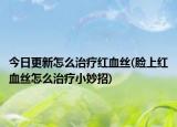 今日更新怎么治疗红血丝(脸上红血丝怎么治疗小妙招)