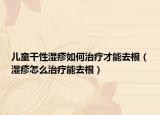 儿童干性湿疹如何治疗才能去根（湿疹怎么治疗能去根）