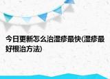 今日更新怎么治湿疹最快(湿疹最好根治方法)