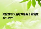 脸盲症怎么治疗效果好（脸盲症怎么治疗）