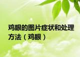 鸡眼的图片症状和处理方法（鸡眼）