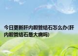 今日更新肝内胆管结石怎么办(肝内胆管结石是大病吗)
