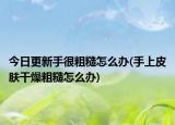 今日更新手很粗糙怎么办(手上皮肤干燥粗糙怎么办)