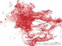 痔疮会发展成直肠癌吗？出现这5种症状，小心“菊部”有癌！