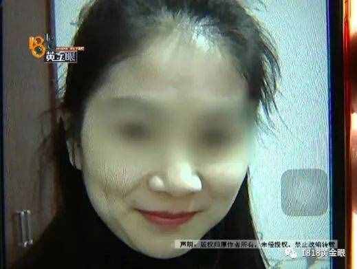 女子去点痣，一颗痣80元，点了110颗！老公怒了，结果……