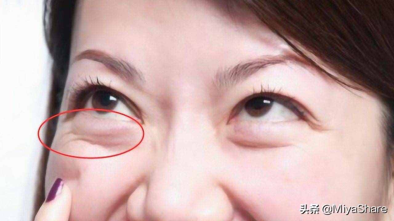 醒醒吧：什么眼霜都救不了黑眼圈！6款眼霜分析：这2款又贵又没用