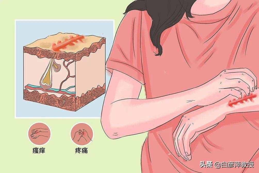 常见的皮肤病有哪些？该如何分类？日常如何预防？