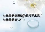 林依晨脑瘤是做的开颅手术吗（林依晨脑瘤\