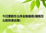 今日更新怎么样去除痤疮(暗疮怎么能快速去除)