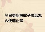 今日更新被蚊子咬后怎么快速止痒