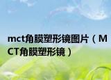 mct角膜塑形镜图片（MCT角膜塑形镜）