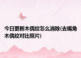 今日更新木偶纹怎么消除(去嘴角木偶纹对比照片)