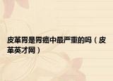 皮革胃是胃癌中最严重的吗（皮革英才网）
