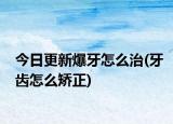今日更新爆牙怎么治(牙齿怎么矫正)
