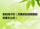 发际线不好（济南发际线调整的效果怎么样）