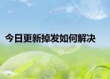今日更新掉发如何解决