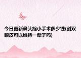 今日更新鼻头缩小手术多少钱(割双眼皮可以维持一辈子吗)