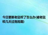 今日更新老鼠咬了怎么办(被老鼠咬几天过危险期)
