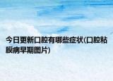 今日更新口腔有哪些症状(口腔粘膜病早期图片)