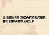 当日最新消息 安倍头发被剃光是真的吗 他的头发怎么这么多