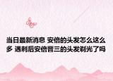 当日最新消息 安倍的头发怎么这么多 遇刺后安倍晋三的头发剃光了吗