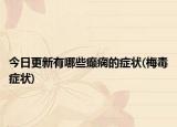 今日更新有哪些癫痫的症状(梅毒症状)