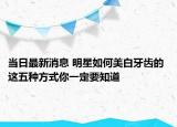 当日最新消息 明星如何美白牙齿的 这五种方式你一定要知道