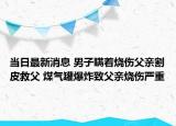 当日最新消息 男子瞒着烧伤父亲割皮救父 煤气罐爆炸致父亲烧伤严重