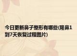 今日更新鼻子整形有哪些(隆鼻1到7天恢复过程图片)
