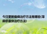 今日更新癫痫治疗方法有哪些(荨麻疹最快治疗方法)