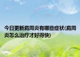 今日更新肩周炎有哪些症状(肩周炎怎么治疗才好得快)