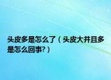 头皮多是怎么了（头皮大并且多是怎么回事?）