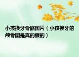小孩换牙骨骼图片（小孩换牙的颅骨图是真的假的）