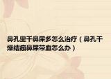 鼻孔里干鼻屎多怎么治疗（鼻孔干燥结痂鼻屎带血怎么办）
