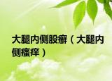大腿内侧股癣（大腿内侧瘙痒）