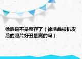 徐浩是不是整容了（徐浩鑫被扒皮后的照片好丑是真的吗）