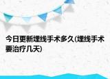 今日更新埋线手术多久(埋线手术要治疗几天)