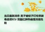 当日最新消息 男子被蚊子叮咬患脓毒症进ICU 双腿红肿热痛情况很危险
