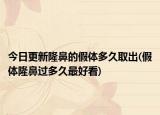 今日更新隆鼻的假体多久取出(假体隆鼻过多久最好看)