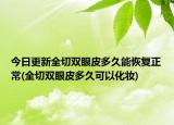 今日更新全切双眼皮多久能恢复正常(全切双眼皮多久可以化妆)