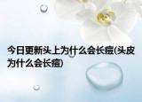 今日更新头上为什么会长痘(头皮为什么会长痘)