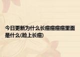 今日更新为什么长痘痘痘痘里面是什么(脸上长痘)
