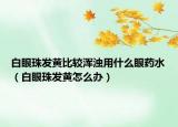 白眼珠发黄比较浑浊用什么眼药水（白眼珠发黄怎么办）