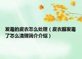 发霉的皮衣怎么处理（皮衣服发霉了怎么清理简介介绍）