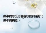 疯牛病怎么得的症状如何治疗（疯牛病病毒）